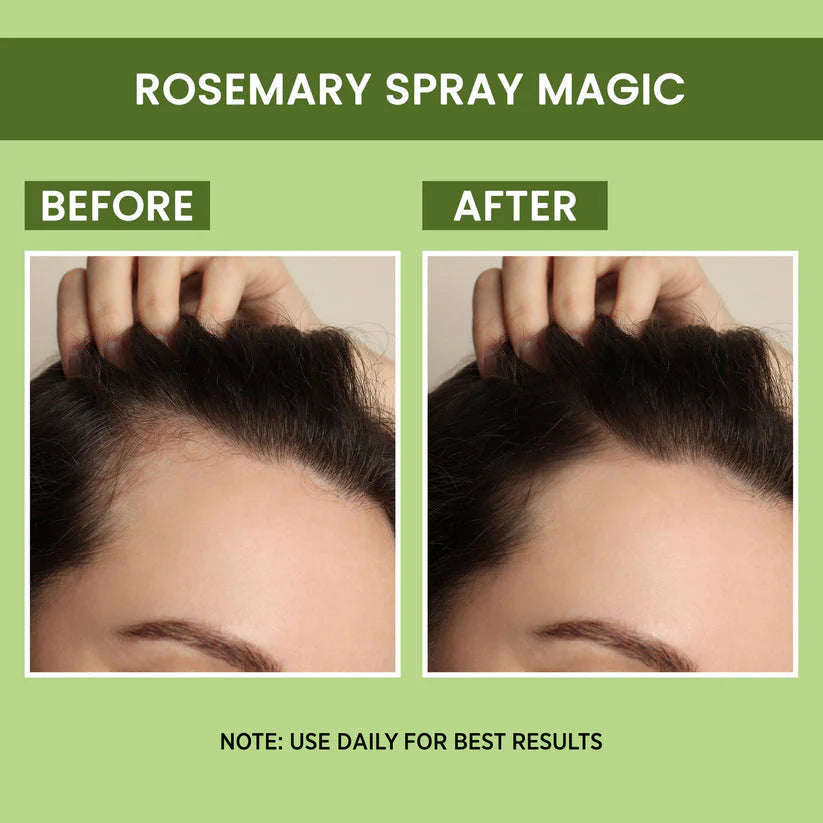 ROSEMARY HAIR SPRAY WATER FOR REGROWTH |(BUY 1 GET 1 FREE)